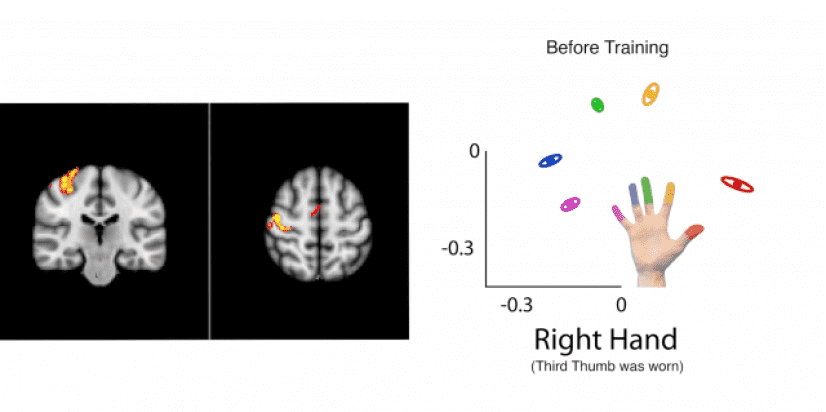 Third-Thumb-body-image-2_e