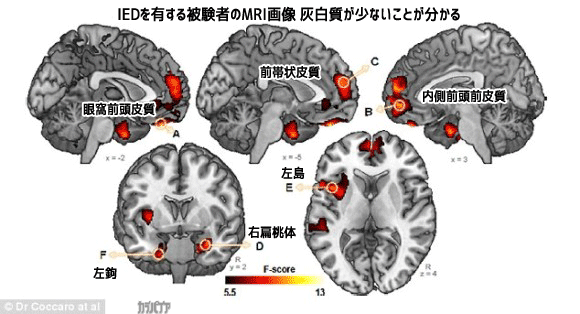 病気 怒り やすい