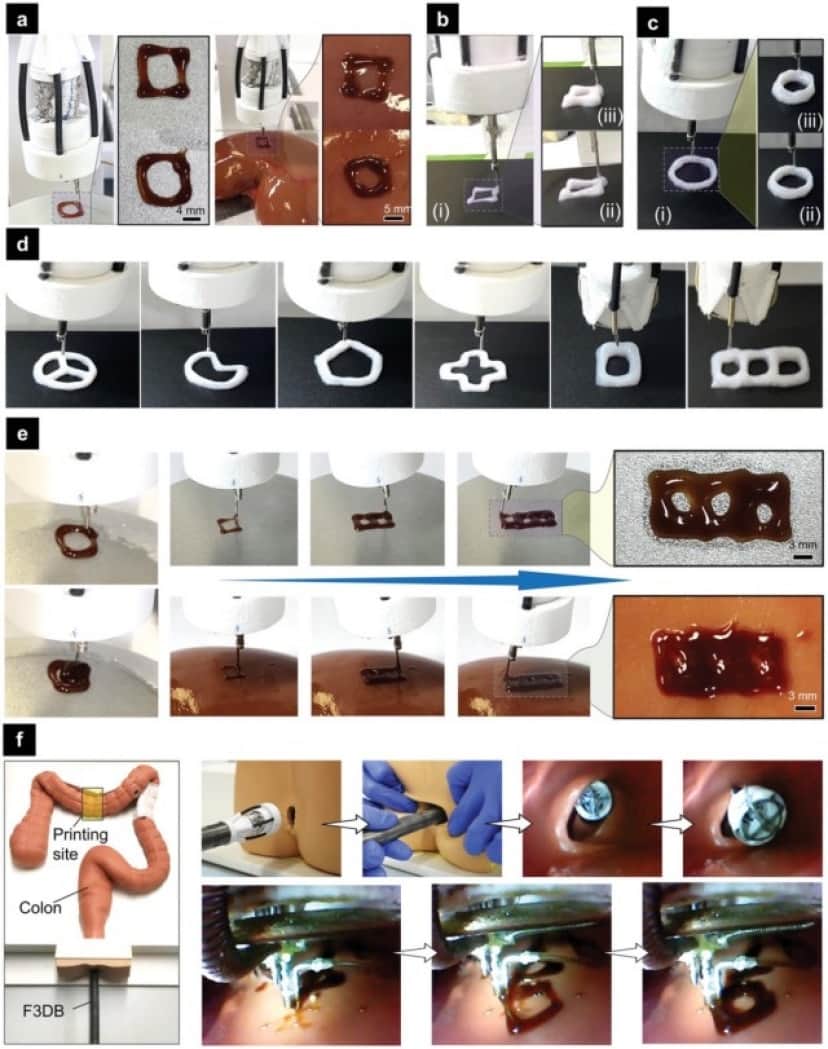 1_e