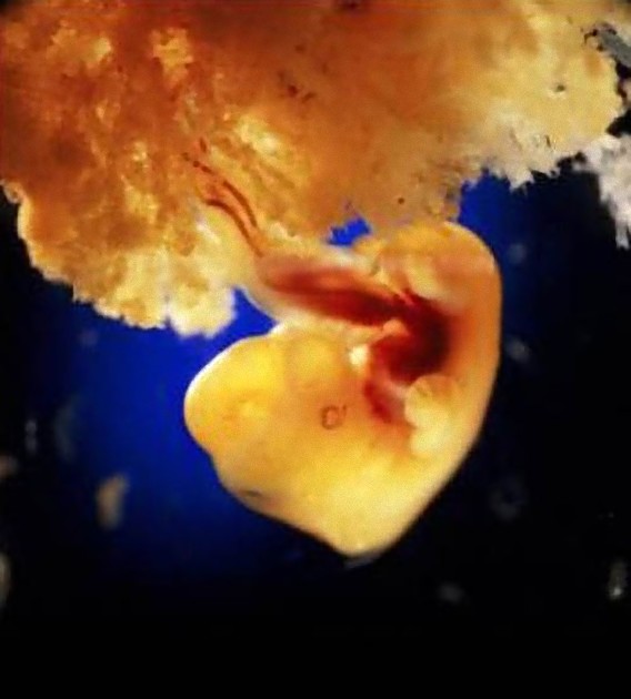 incredible_photos_a_child_is_born_640_15_e