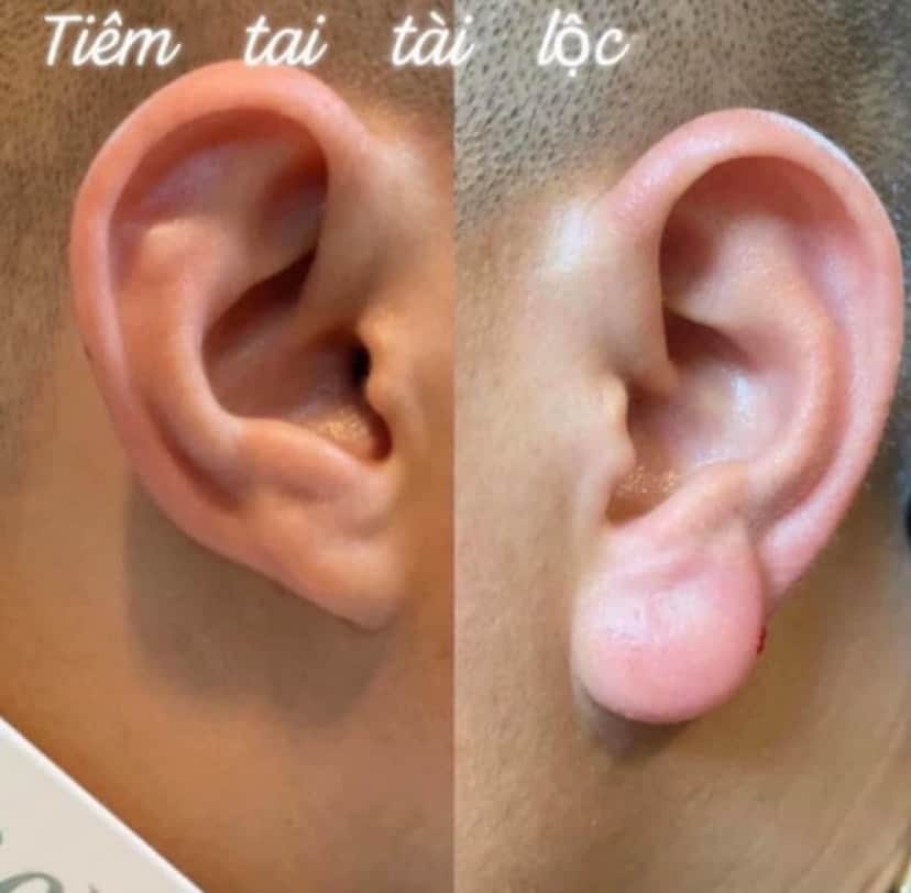 ear _e
