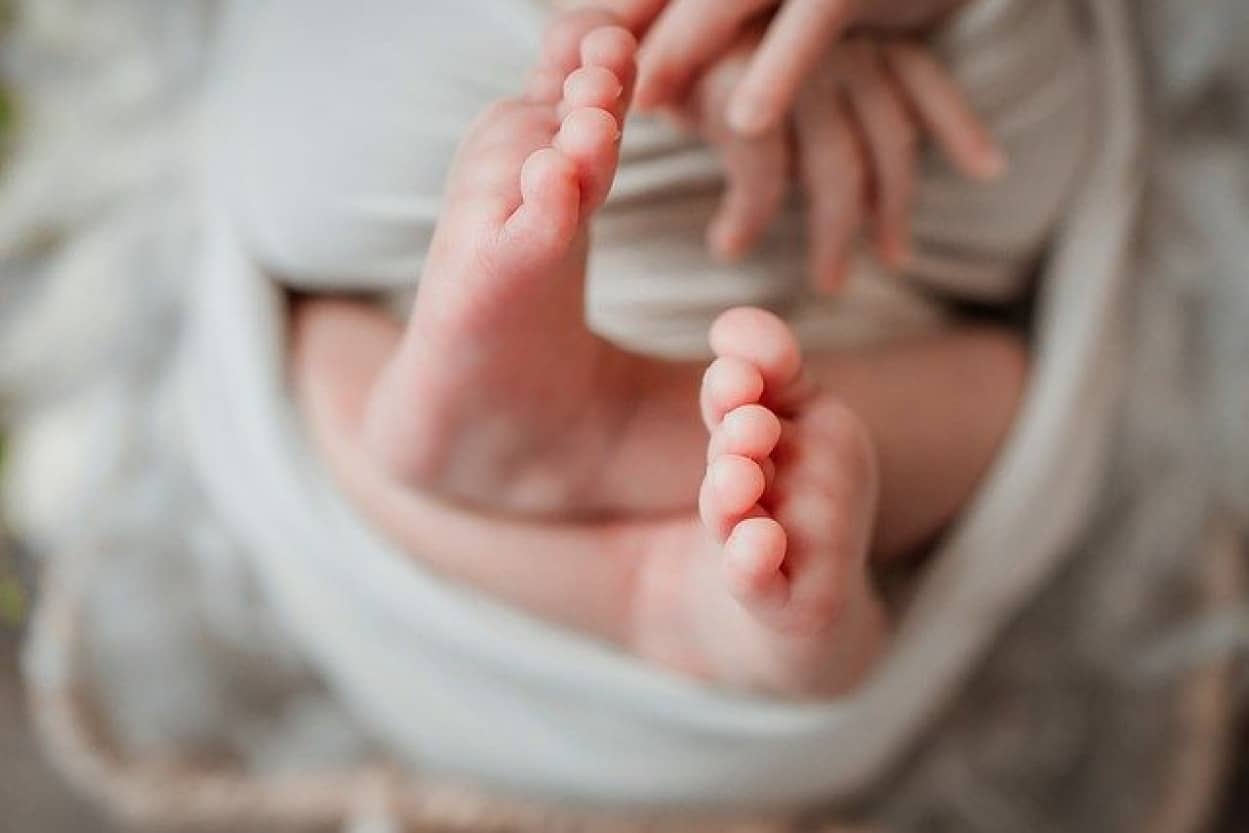 ブラジルで 本物 の尻尾を持った赤ちゃんが誕生 カラパイア