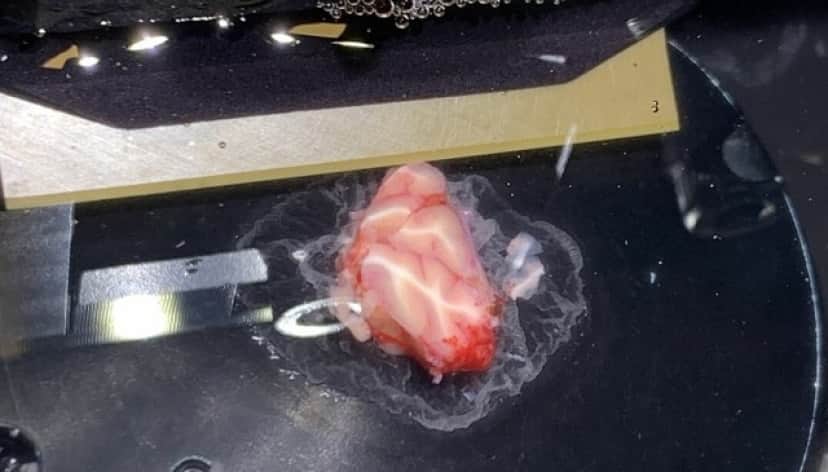 1_e1