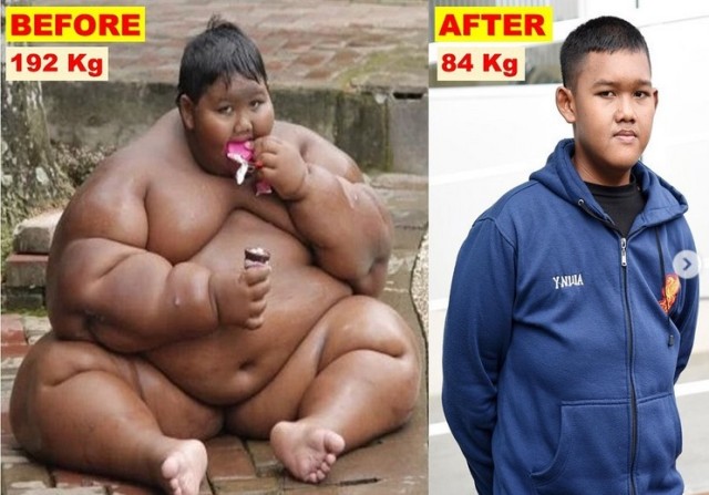 「世界一の肥満児」と呼ばれたインドネシアの少年の今