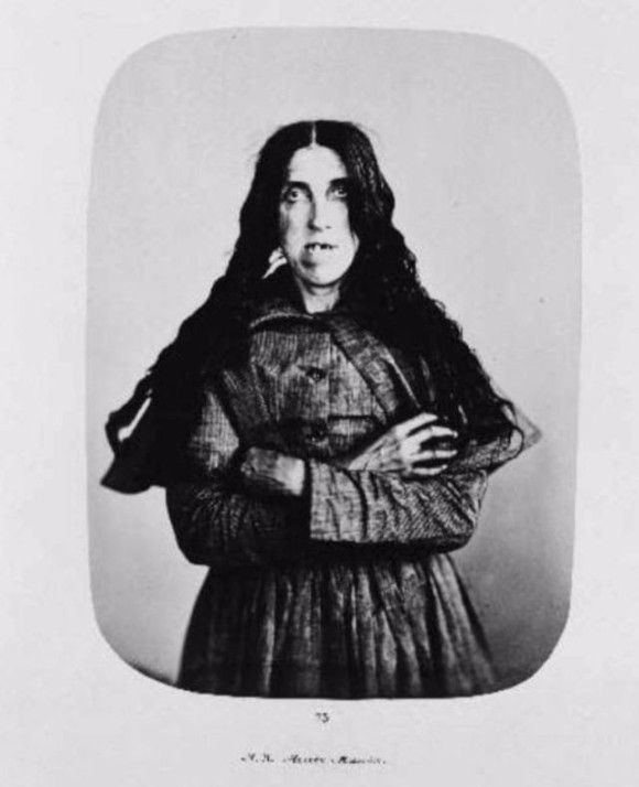 19世紀のイギリスで 最も悪名高い精神病院 ベドラム に収容された患者の写真 カラパイア