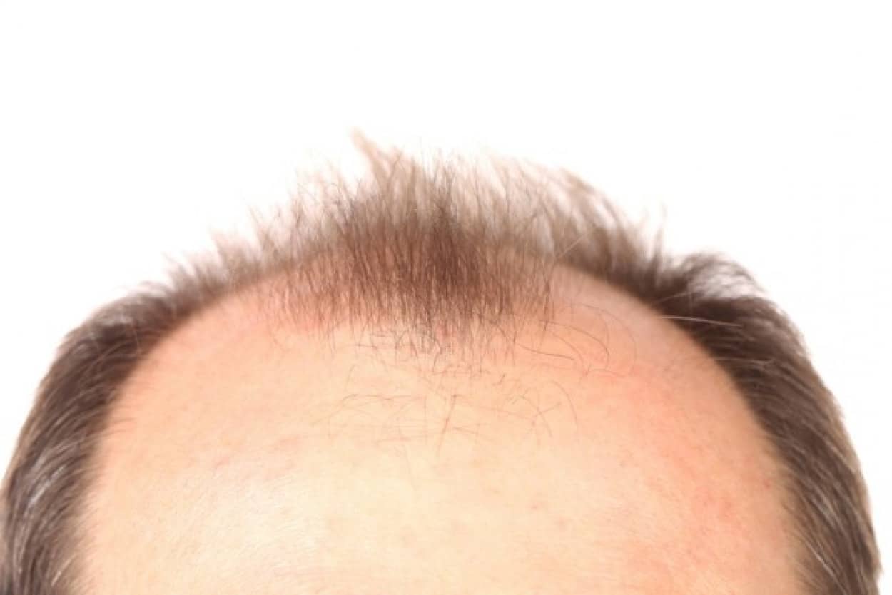 iStock-481506649_e