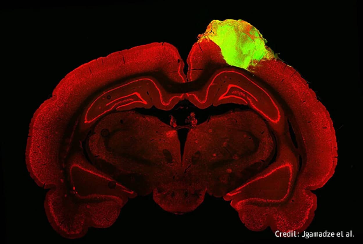 ラットに移植した人間のミニ脳が結合し視覚刺激に反応