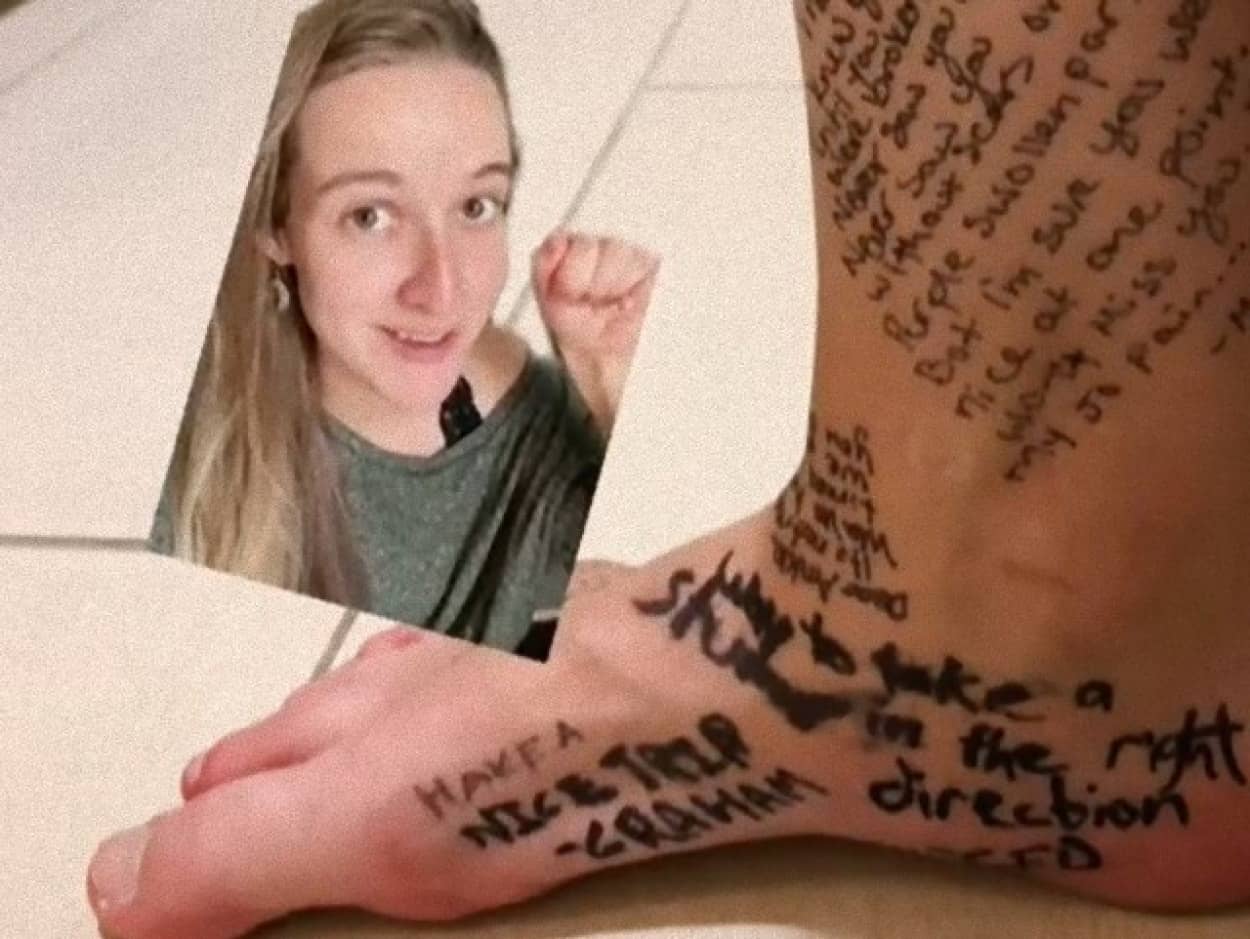 脚の切断を余儀なくされた女性、足と別れを告げる前に無数のメッセージが綴られる