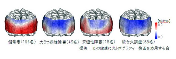 8_e25