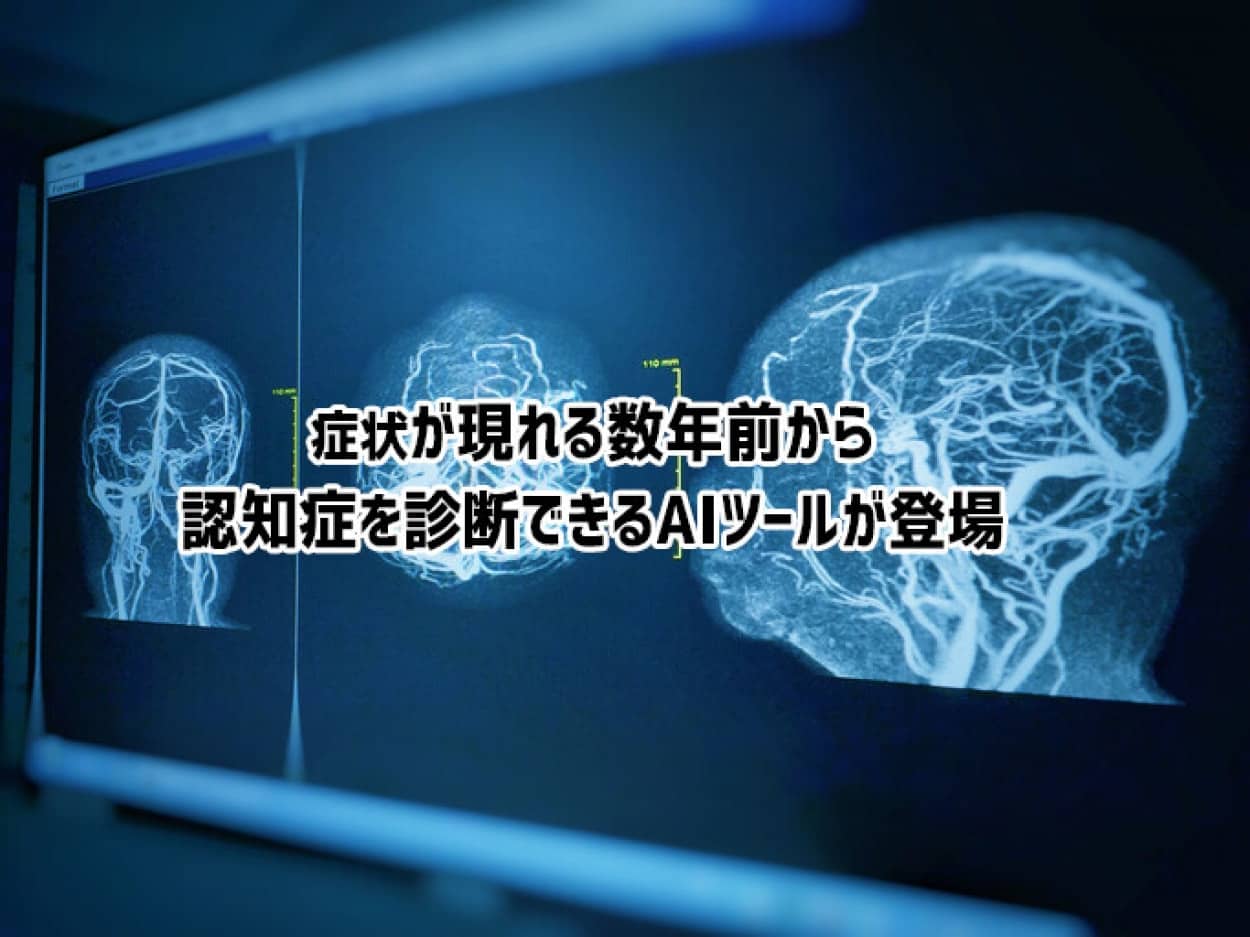 症状が現れる数年前に認知症を判断できるAIツールが誕生