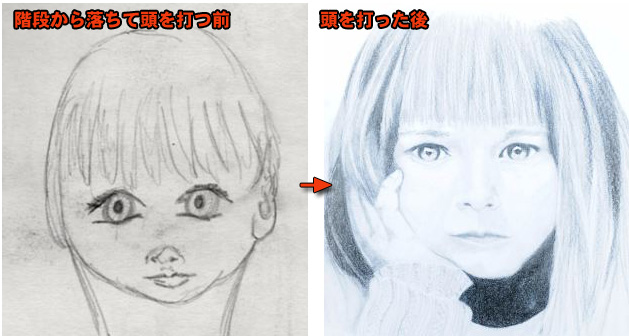 階段から落ちて頭を打ったら突如絵の才能が開花 九死に一生を経てアーティストとなった女性 イギリス カラパイア