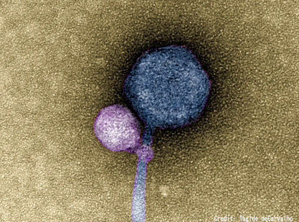 ウイルスを捕食して増殖する吸血鬼のようなウイルスを発見。新たな抗ウイルス療法の鍵に