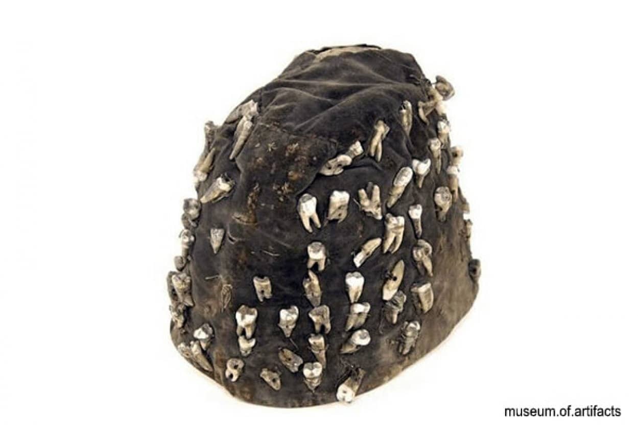 19世紀イギリスの路上歯医者が被っていた88本の虫歯が縫い付けられた帽子