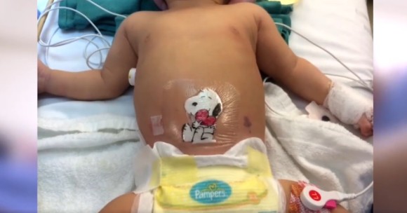 手術した子供たちを元気づけるため 治療後の患部に手描きのイラストパッチを付けてあげる医師 アメリカ カラパイア