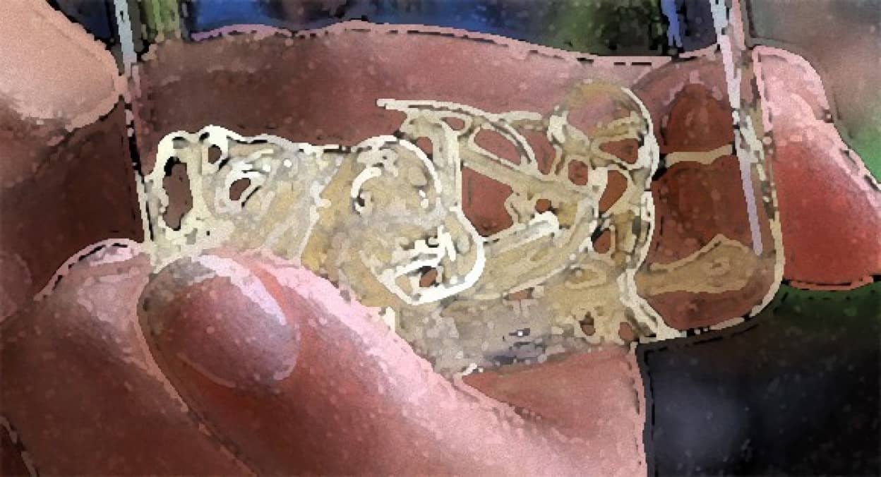 寄生されたらヤバイ 地球で最も恐ろしい10の寄生虫 閲覧注意 カラパイア