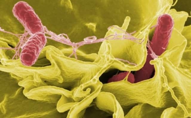 エクササイズ用の振動マシンに免疫細胞や腸内細菌の構成を健全化する効果が確認される 米研究 カラパイア