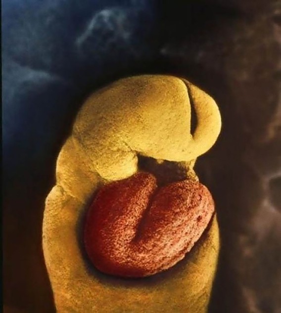 incredible_photos_a_child_is_born_640_11_e