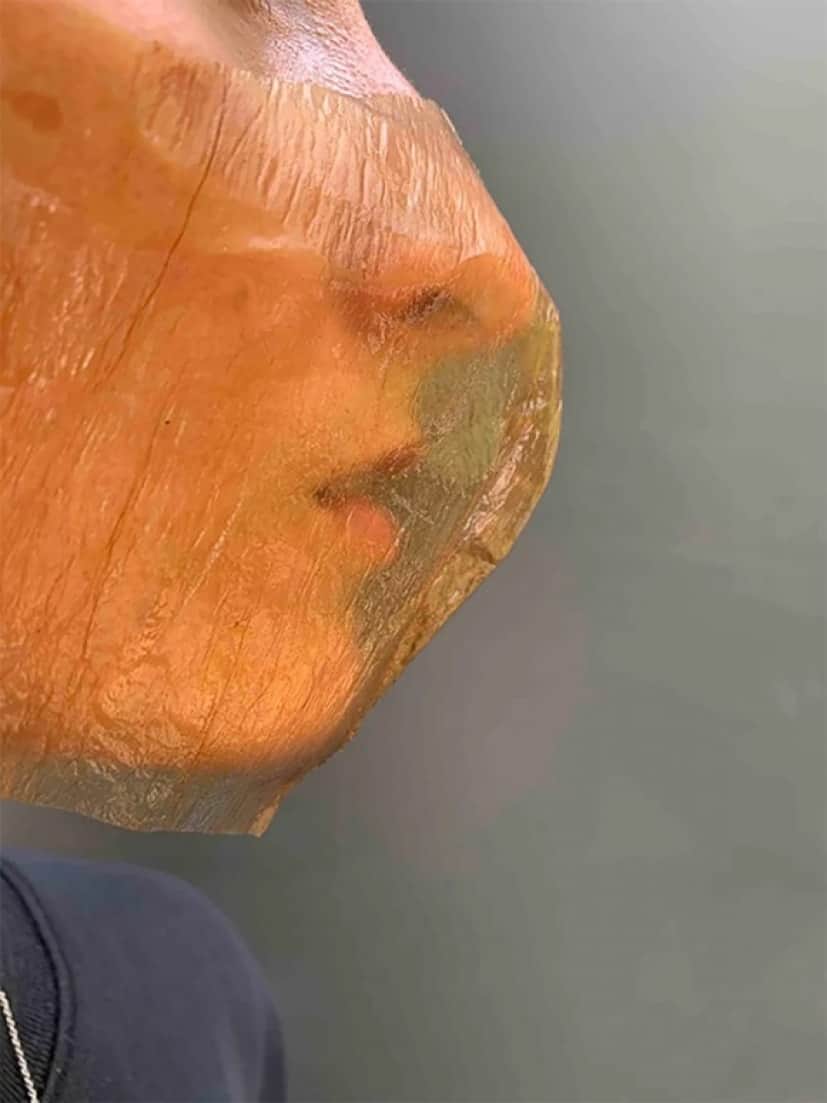 5_e1