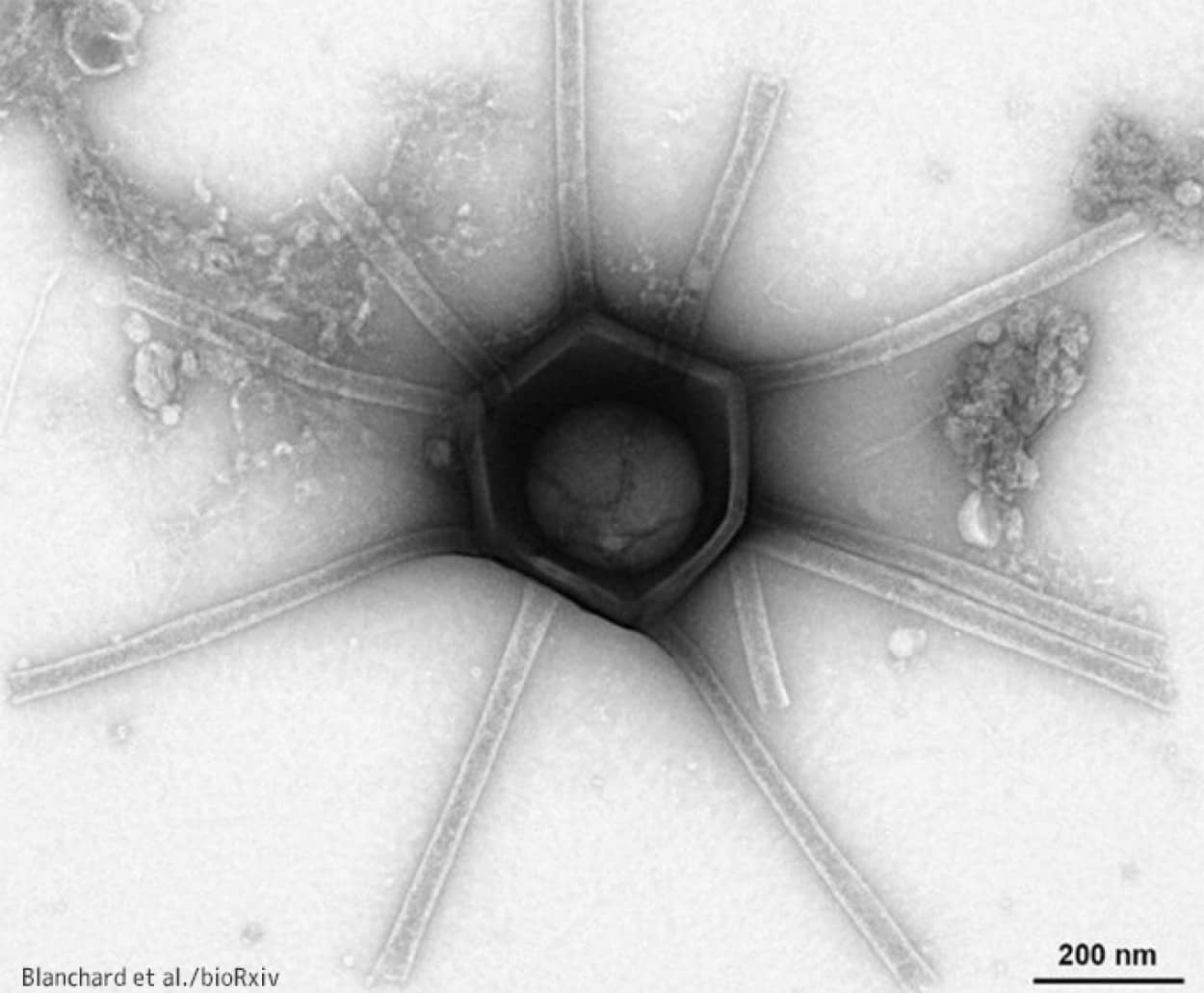 マサチューセッツ州で発見された多種多様な巨大ウイルス様粒子