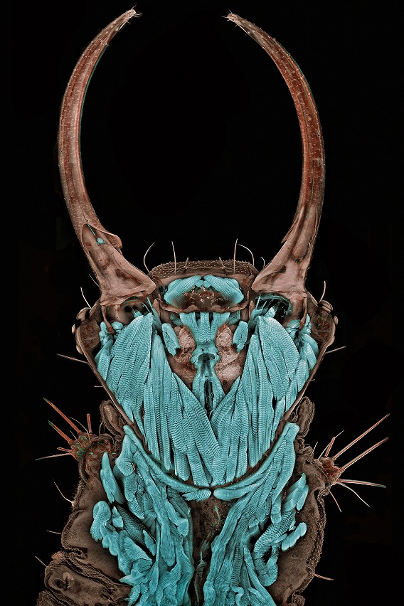 bp2
