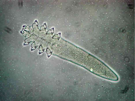 demodex_folliculorum_2