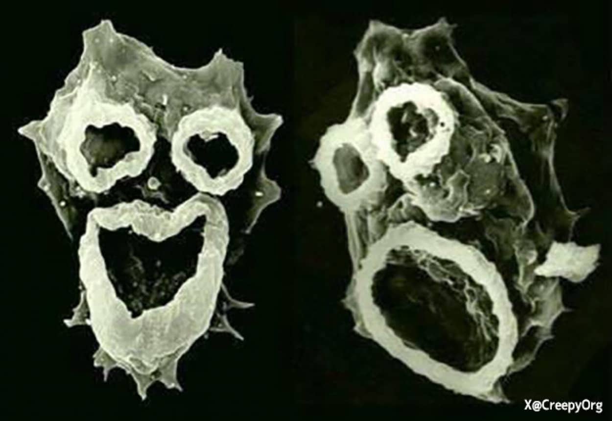 殺人アメーバ「フォーラーネグレリア」の顕微鏡拡大写真が悪魔すぎた