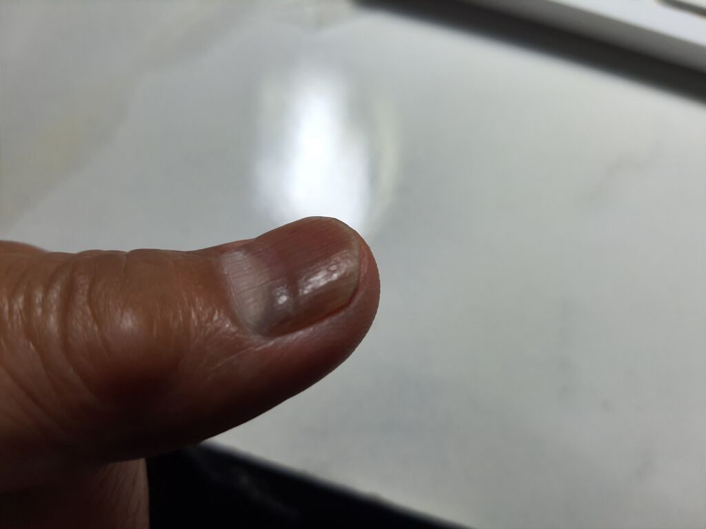 爪にも来てますよ Bな日常 爪にも来てますよ Bな日常