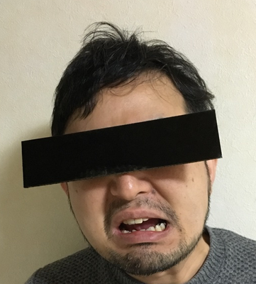 装着3