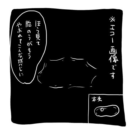 7-1