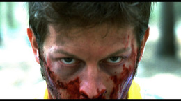 rabies4