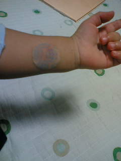 ムヒパッチ ゆっくりママのゆっくり子育て日記