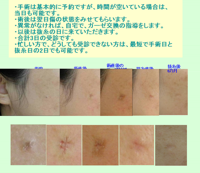 イメージ 5