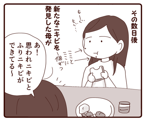 ニキビ①3