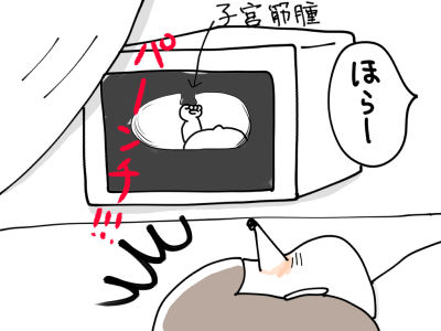 胎内?記憶by洋おまけ