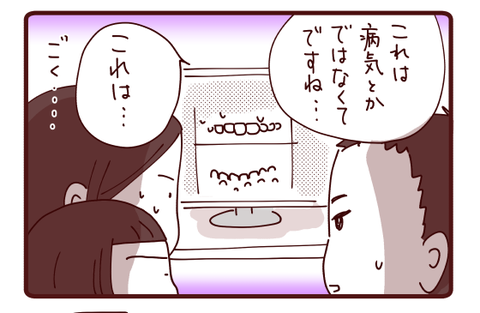 永久歯がないってことは…3
