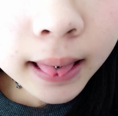 キャプチャ