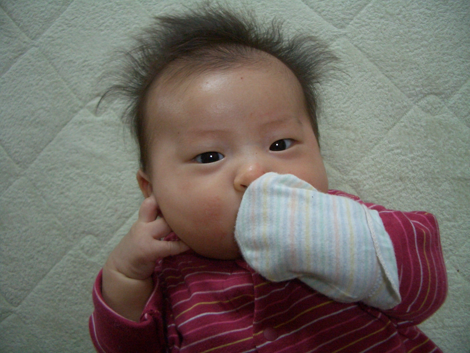 子供 顔 ひっかき 傷