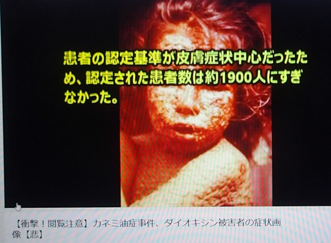 カネミ油症 刑法で検索 環境歴史好旅行きのkazusantk