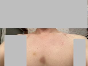 Image2-2