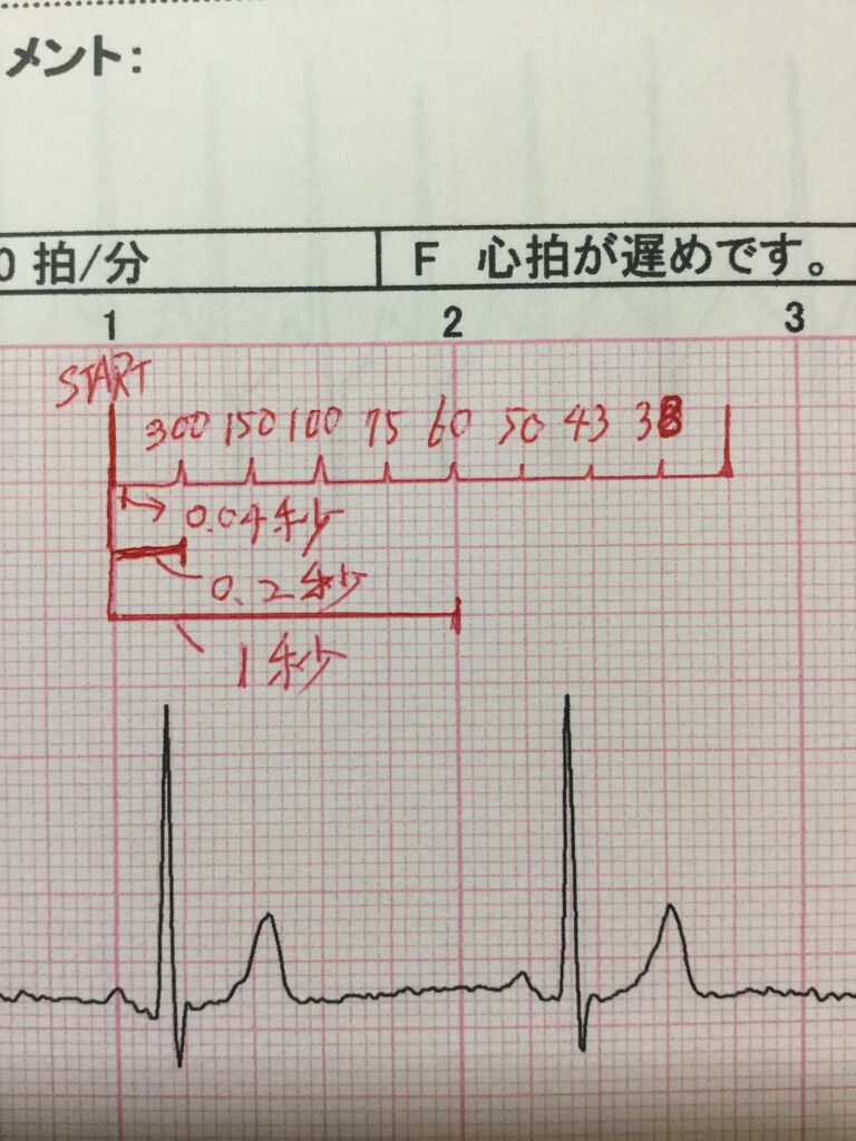 心拍 計算 心電図 数