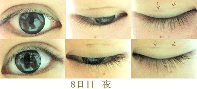 埋没経過ブログ Livedoor Blog ブログ