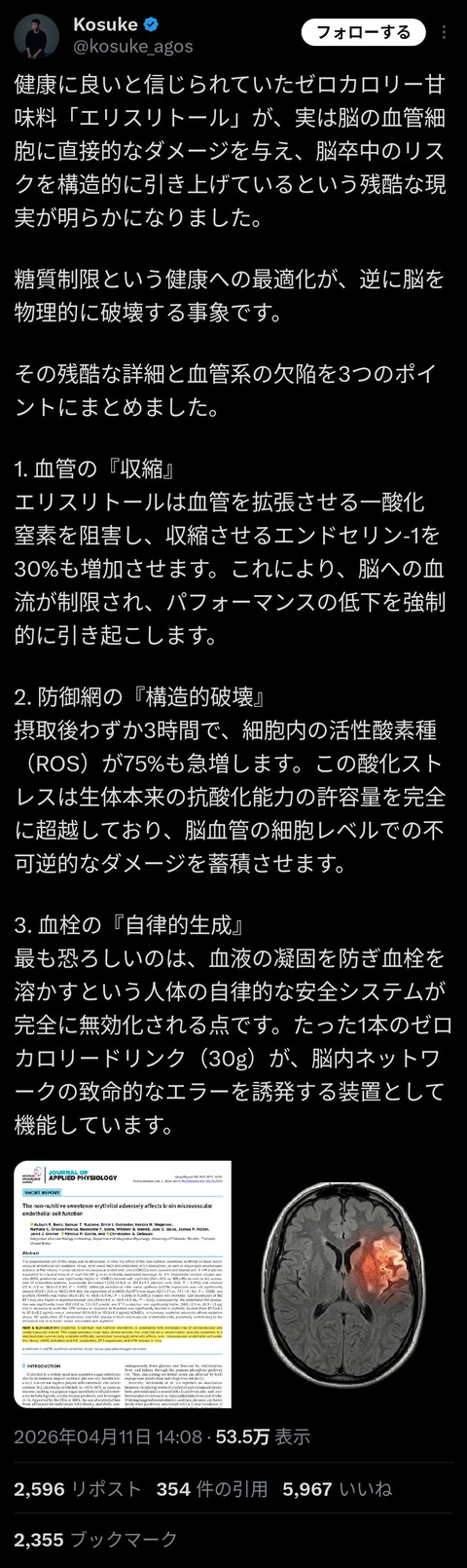 【悲報】ダイエットコーラ飲んでた馬鹿全員！脳卒中の危険が確認されるwwwwwwwwwwwwwwwwwwwwのサムネイル