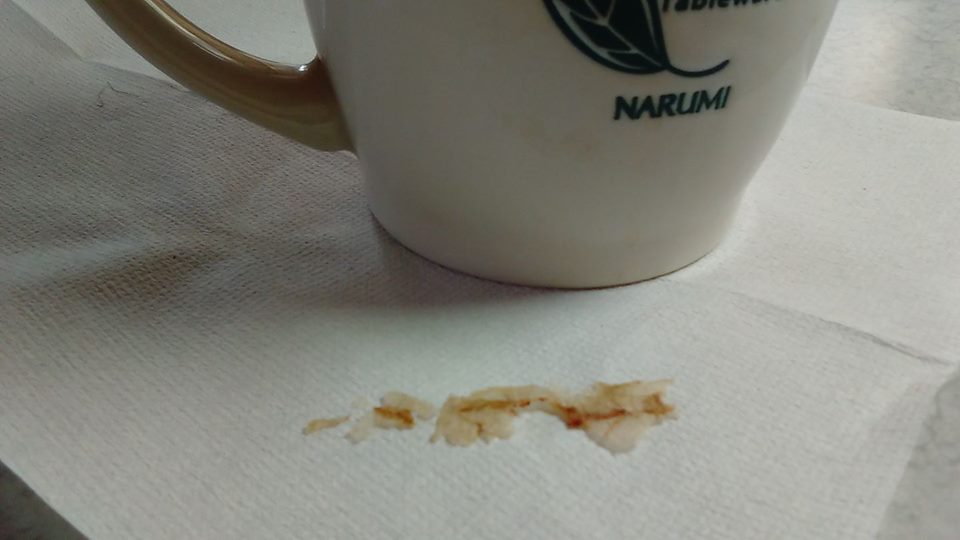 術後の切り傷処置は医療用接着剤 Keinakamuraのblog 術後の切り傷処置は医療用接着剤 Keinakamuraのblog