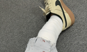 260717-Injury01