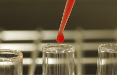 【恋愛】付き合い始めた彼氏に性病検査をしてもらいたいんだけど