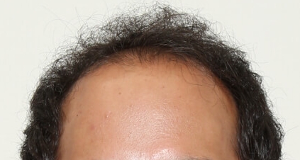 WS000033