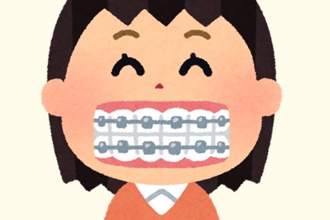 彼女 あのね 今度歯の矯正しようと思うんだけど ワイ へぇ いいじゃん 彼女 それでね 恋愛まとめ速報 彼女 あのね 今度歯の矯正しようと思うんだけど ワイ へぇ いいじゃん 彼女 それでね 恋愛まとめ速報