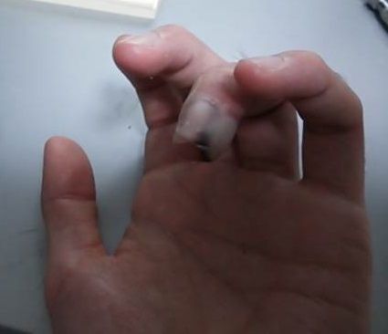 グロ注意 けもてっく キズパワーパッドの凄さを知る けもろぐ