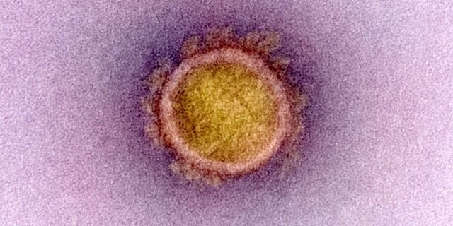 NIH__coronavirus__49597768447_972eba3aae_o-1280x640 (640x320)