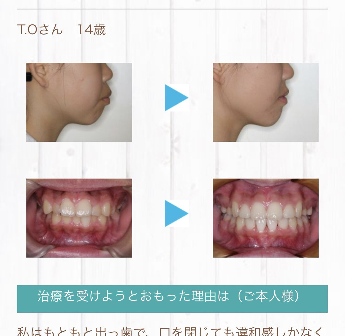 歯列矯正してるやついる 健康ちゃんねる 2ちゃんまとめ
